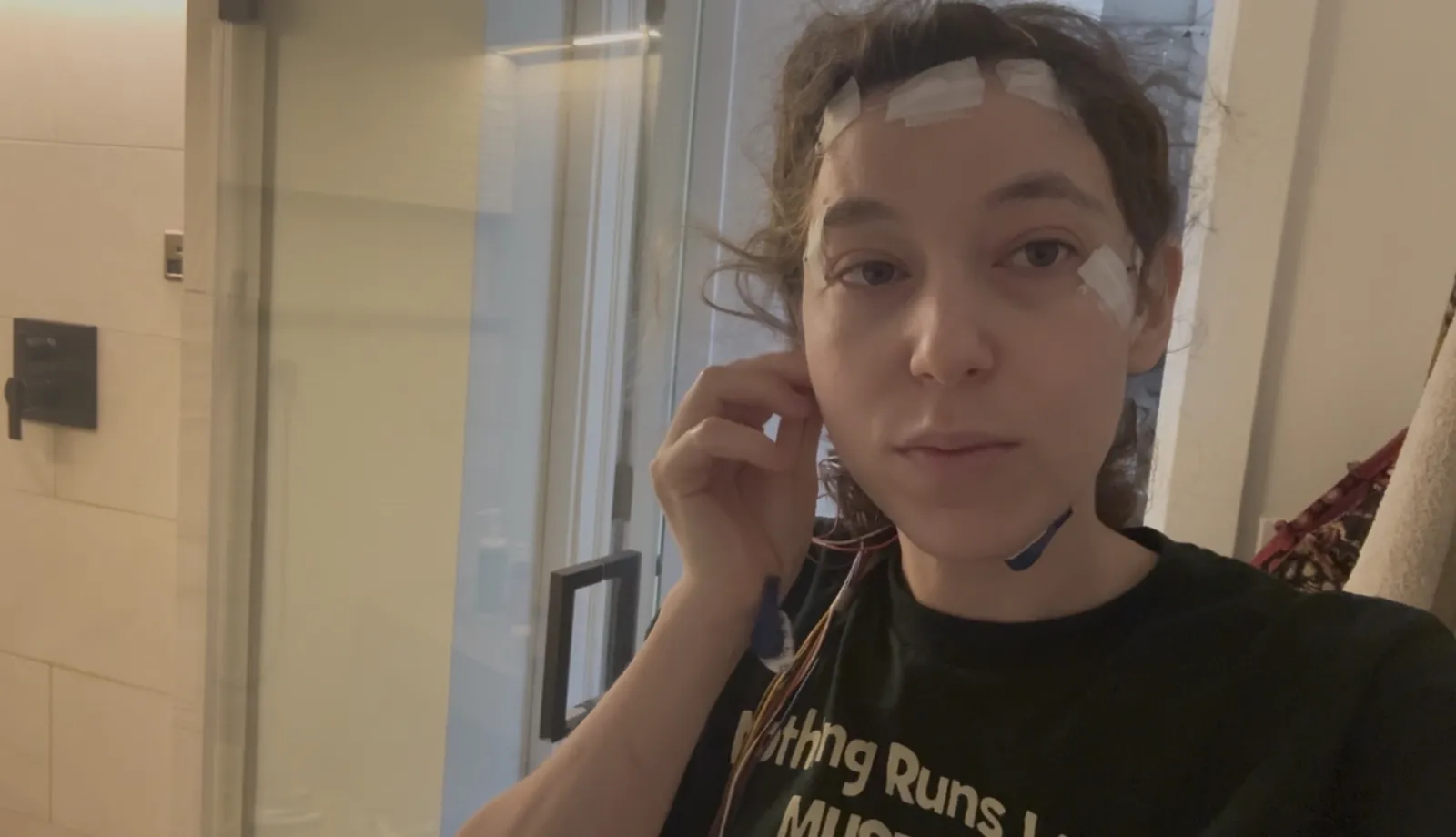 Dashiell wearing the anti-acne electrode setup with electrodes taped around the eyes and on the chin.