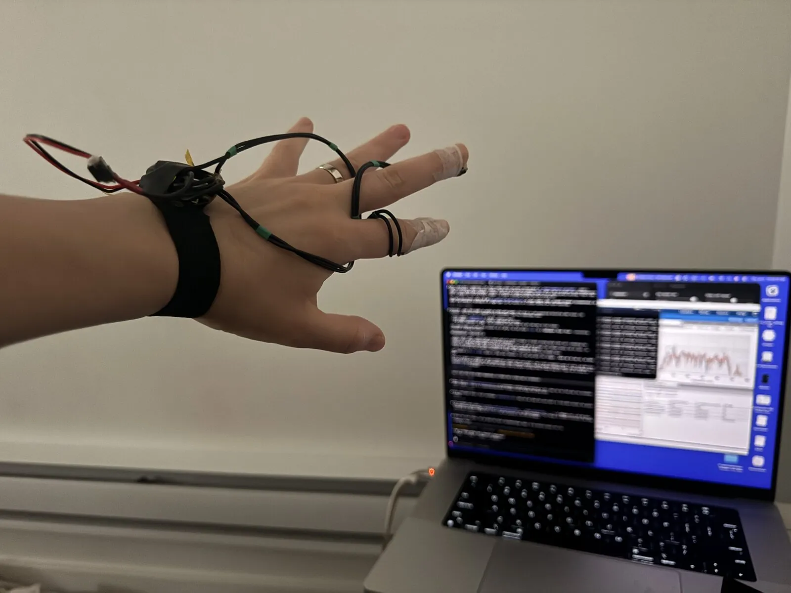 The sleep-data wearable — sensors on my hand with the live data on the laptop behind